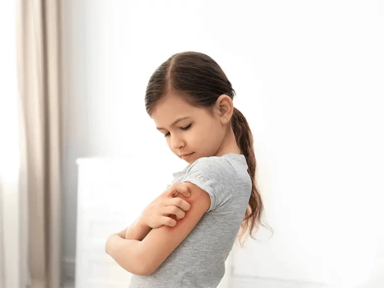 Jeune fille qui gratte son bras qui démange.