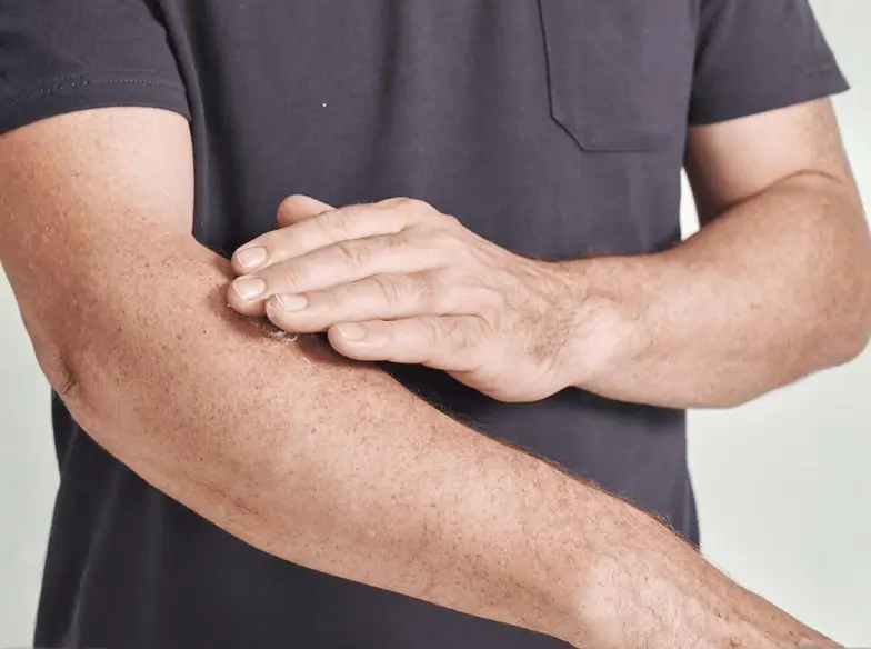 Man rubbing cream onto his arm.