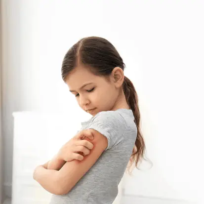 A young girl in a gray shirt looks down at her arm with eczema with a concerned expression, gently touching a red irritated spot in a softly lit room.
